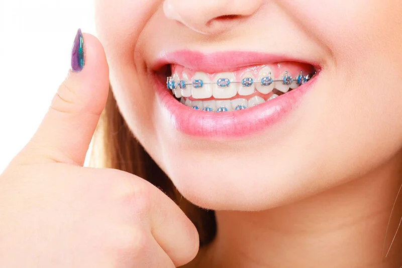 Orthodontics-Glen-Ellyn.jpg