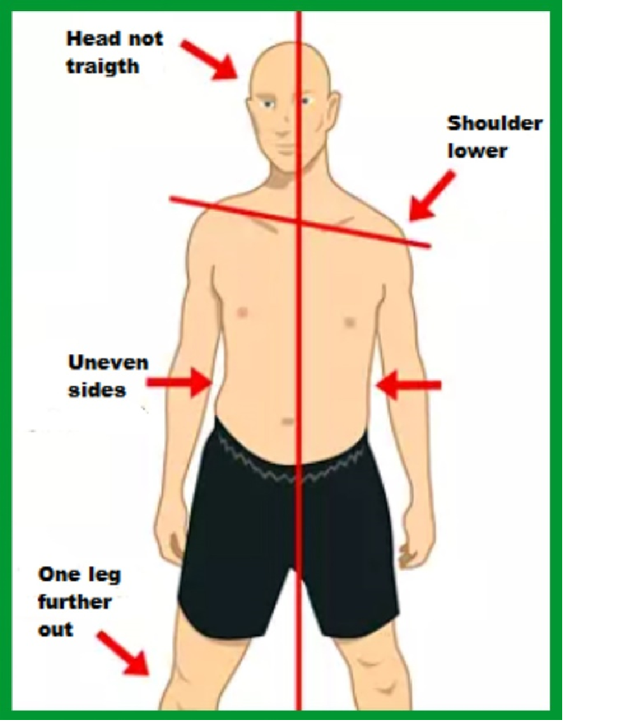 Understanding And Fixing Back Problems - At Home