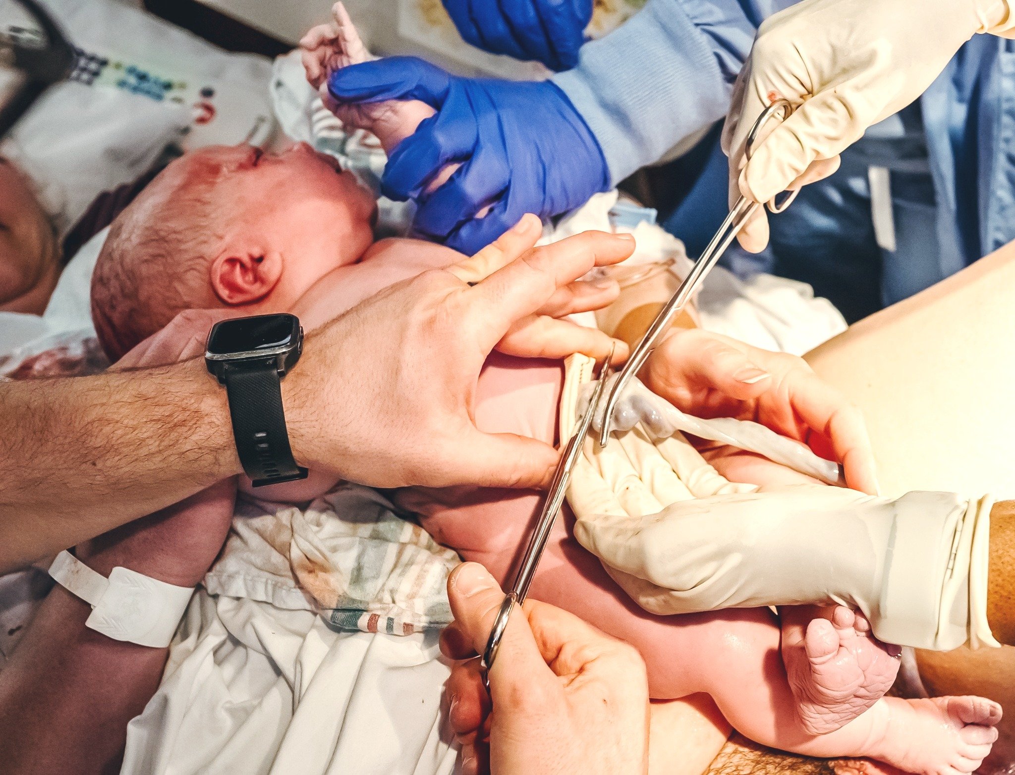 Cutting the cord! I love all of the hands in this image, supporting baby and mama as dad separates babe from placenta. His first home. 

#birth #birthstory #birthgrandrapids #birthphotographer #birthphotography #birthdoula #hospitalbirth #hospitalmid