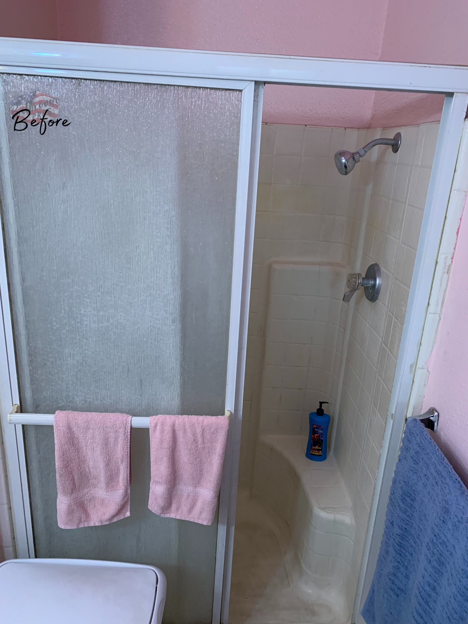 Fitzpatrick shower Before.png
