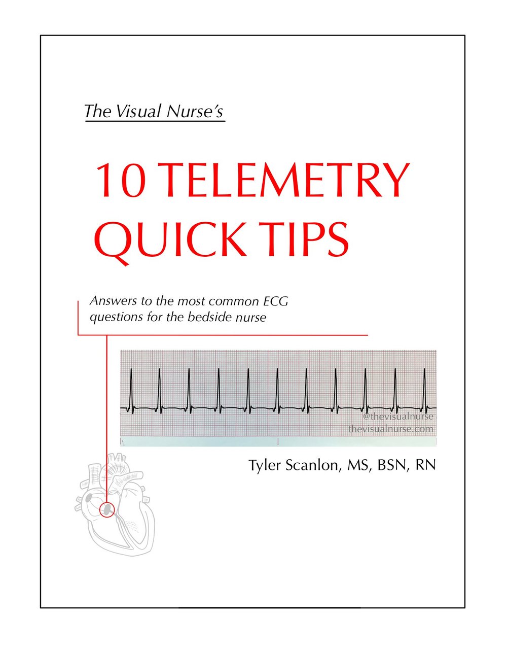 10 Telemetry Quick Tips — The Visual Nurse
