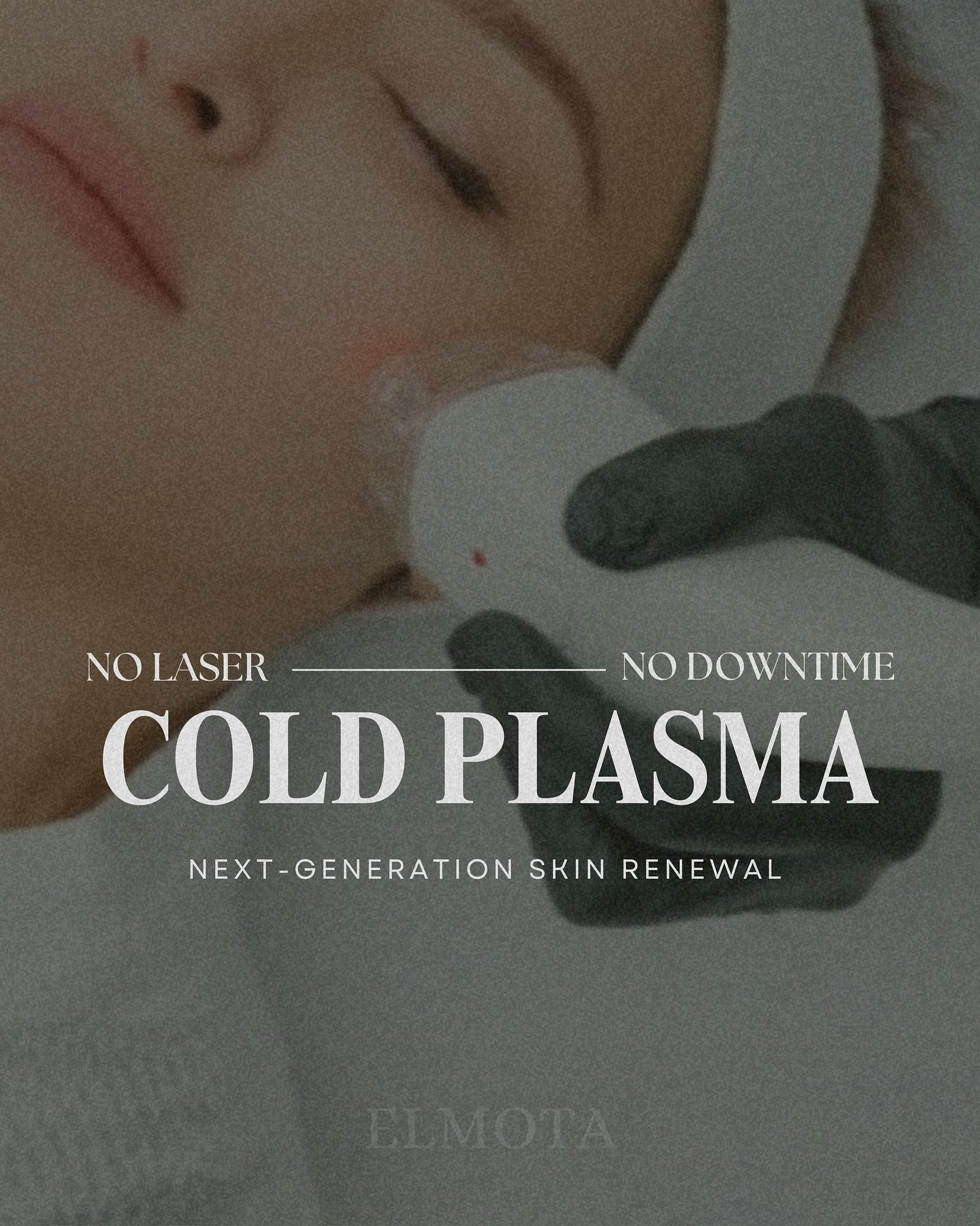 ✨ Now at Elmota Medical Spa ✨

Experience the future of skin renewal with Cold Plasma Resurfacing &amp; Rejuvenation.

This non-laser, non-thermal treatment uses over 13,000 volts of plasma energy to stimulate collagen, refine texture, and enhance sk
