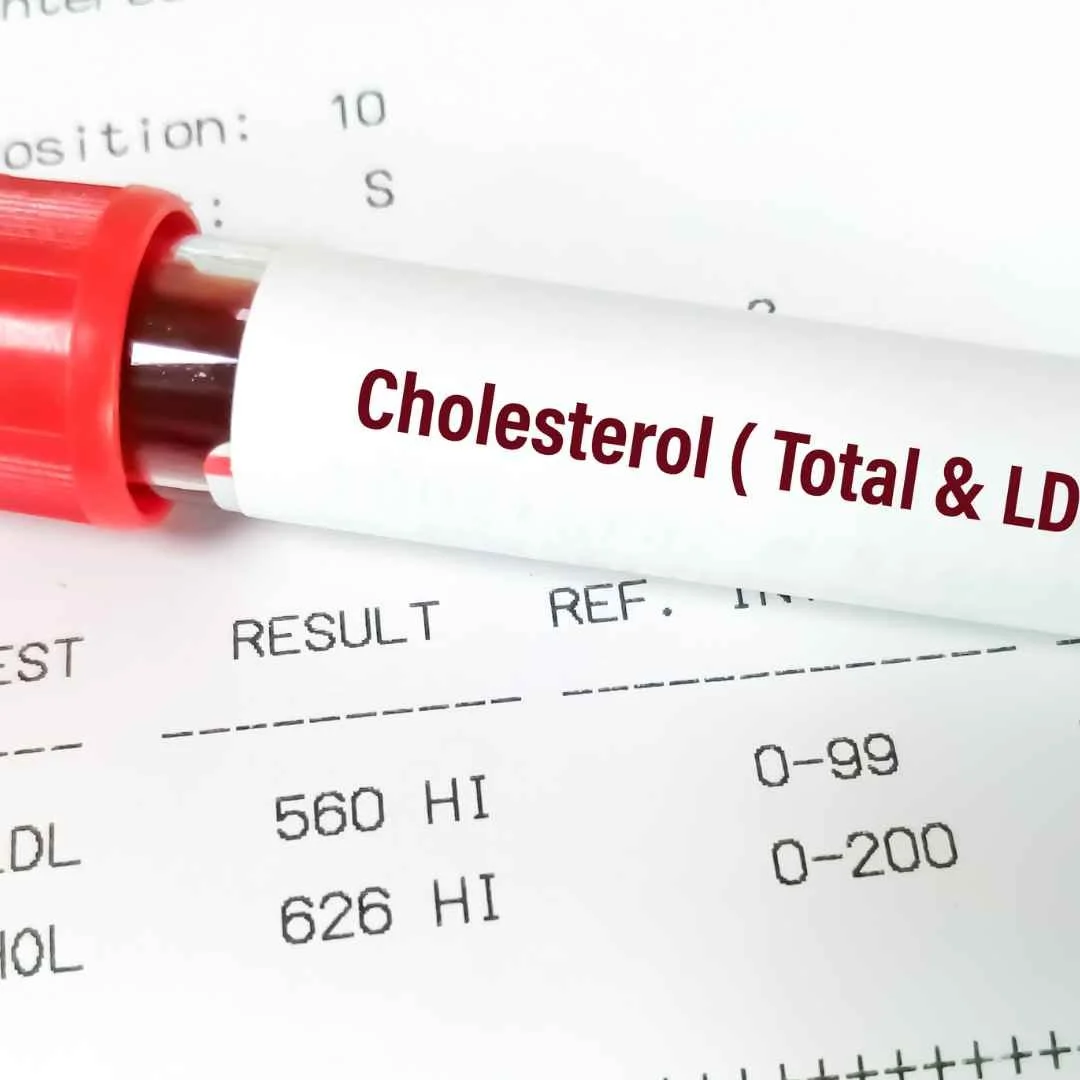 Perimenopause &amp; Cholesterol: Why It Spikes in Your 40s + What To Do