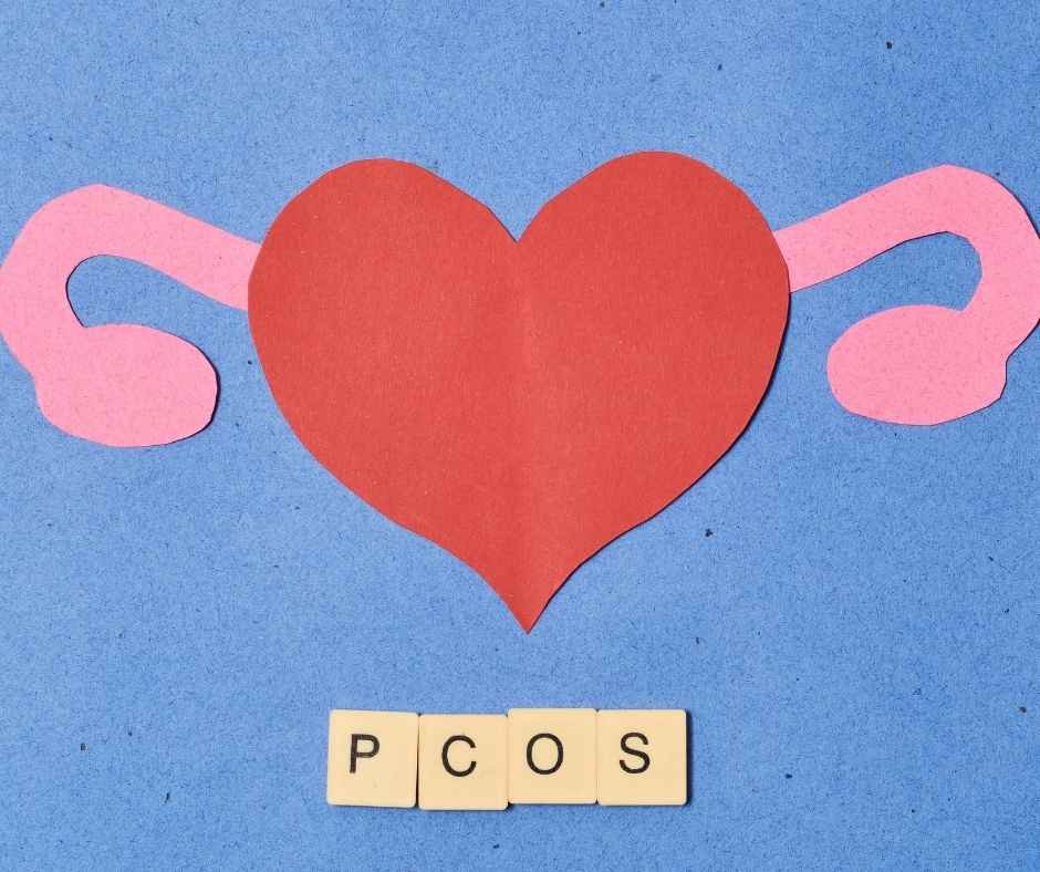 Optimal PCOS Management: Diet, Lifestyle, and Supplementation