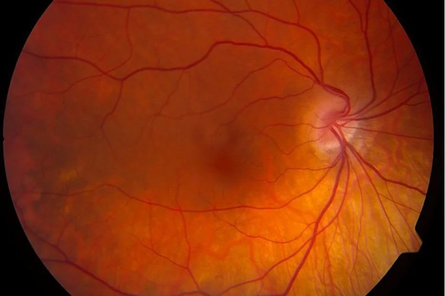 Retina Associates of South Texas