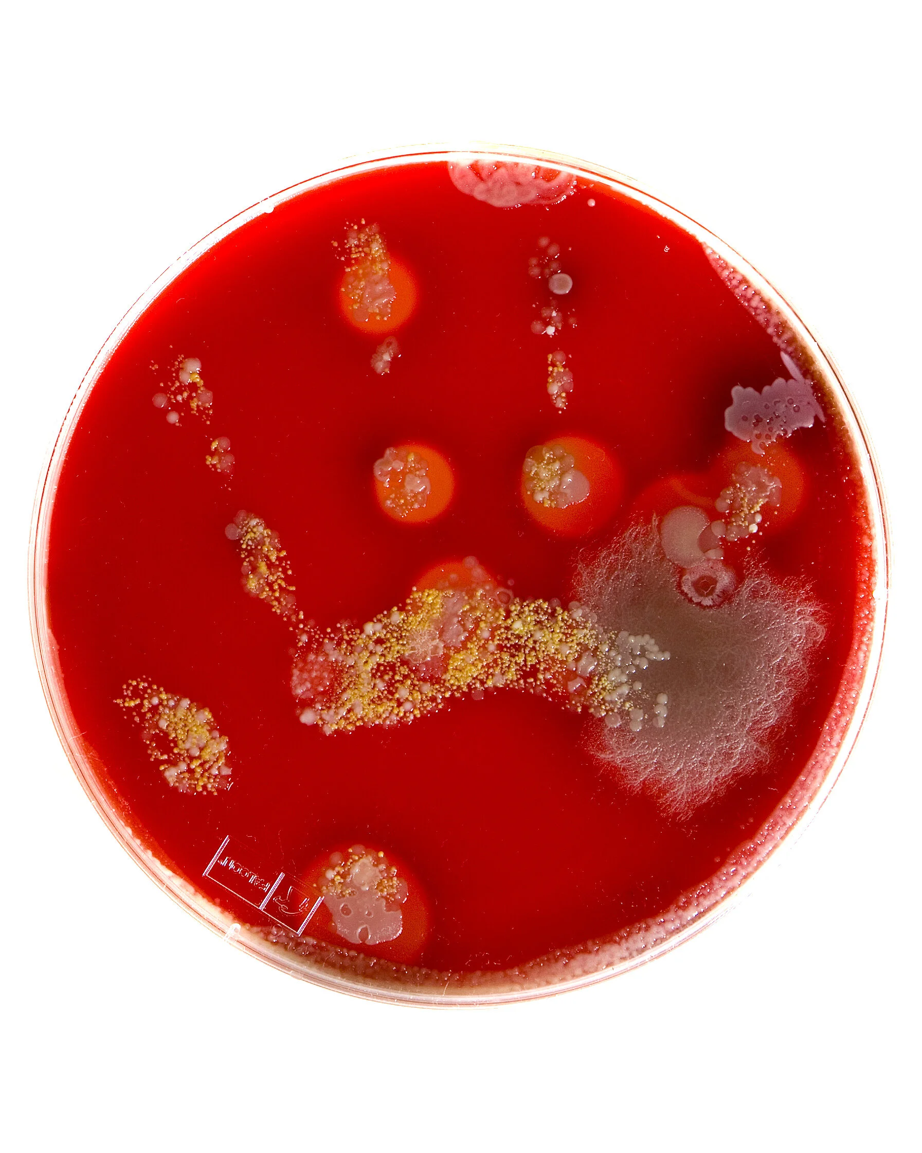 Germs byTiim Gray-02.jpg