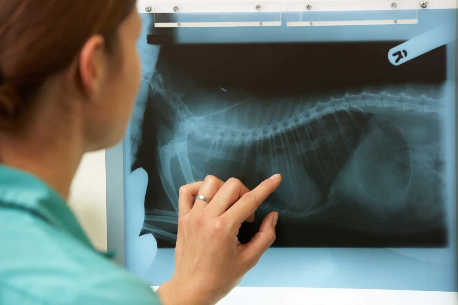 Person examining a chest X-ray film on a lightbox.