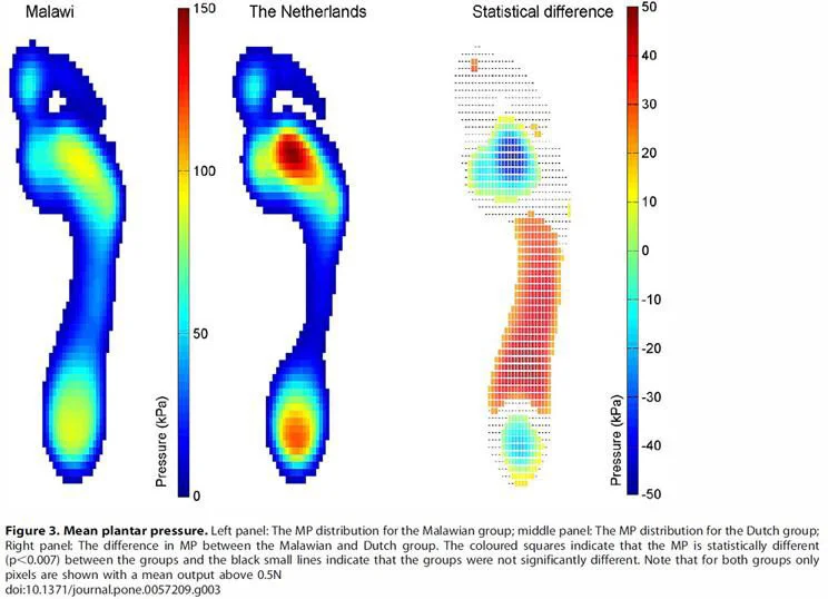 Plantare Druckverteilung