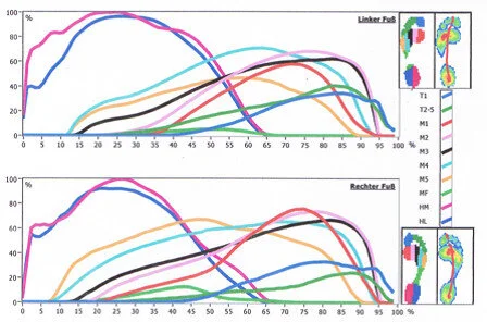 Dynamische Fussanalyse (rs-footscan-Analyse)