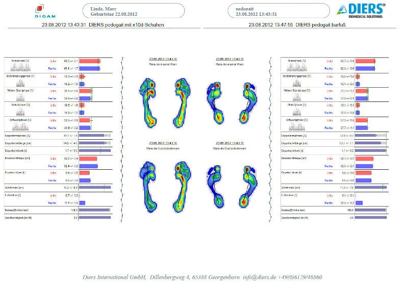 Kraftlinienvergleich X10D vs. Barfuss