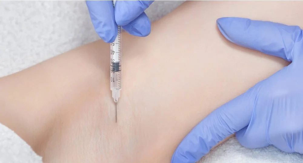 Injeksjonsbehandling hyperhidrose