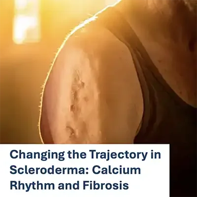 Changing the Trajectory in Scleroderma: Calcium Rhythm and Fibrosis
