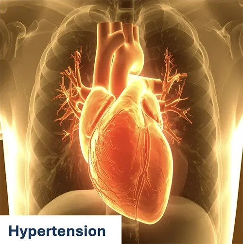 Hypertension