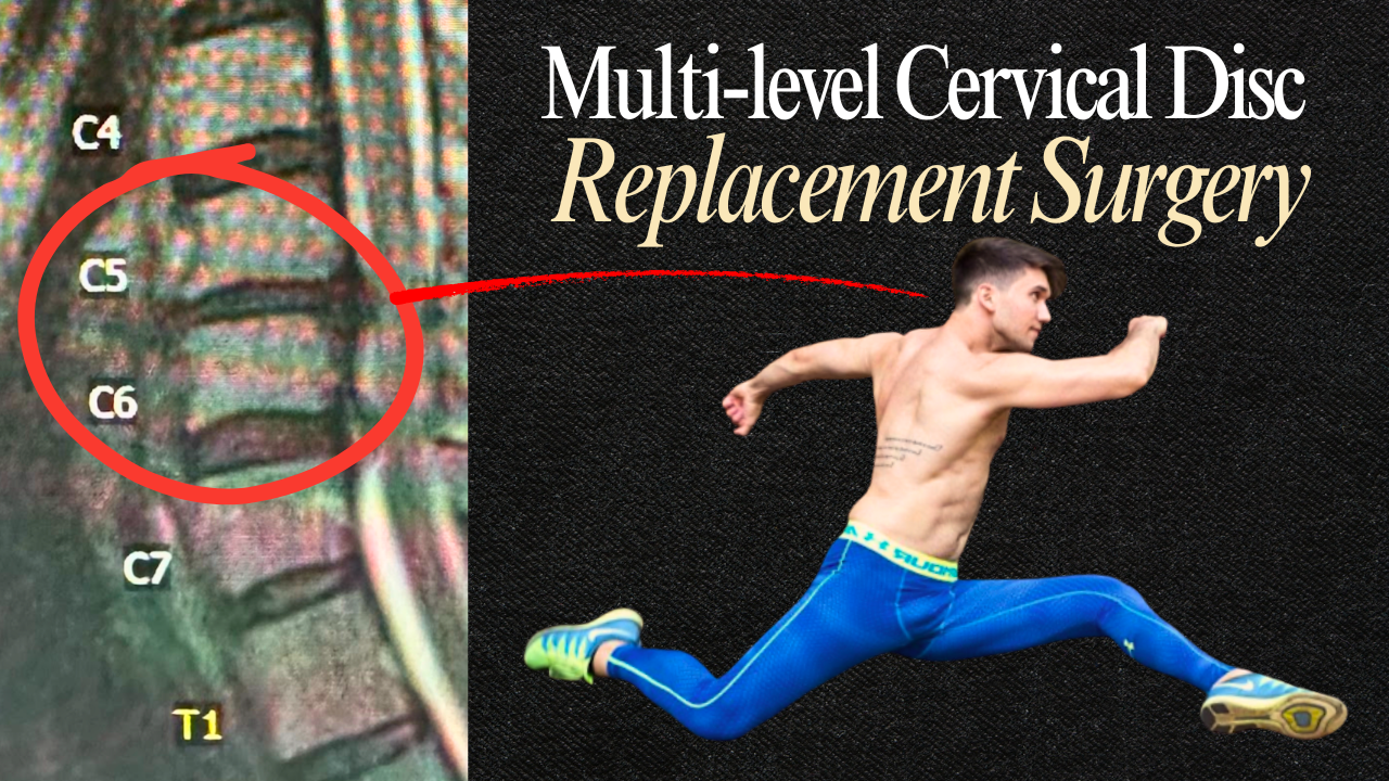 Recovering from 2 Cervical + 3 Lumbar Disc Herniations, Neck Surgery, Sciatica (with Hypermobility)
