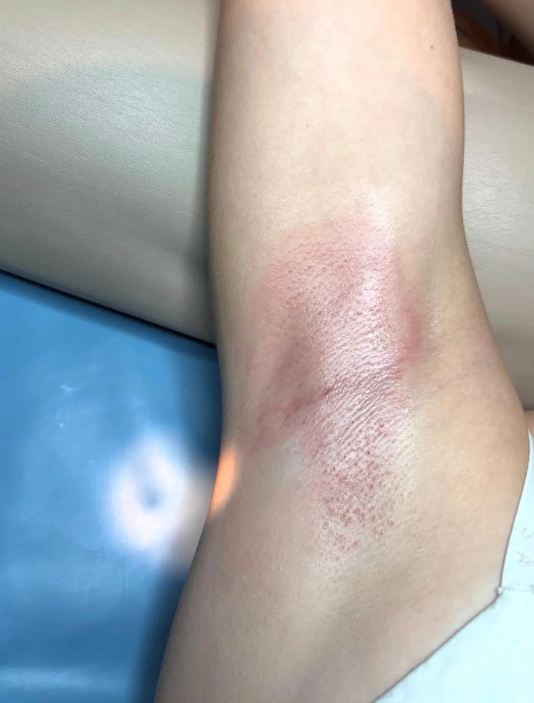 @estheticsbykhloee Say goodbye to the razor routine.
Underarm waxing is quick, smooth, and long-lasting. #SSAKOKOMO #SummitSalonAcademy #KokomoBeauty #KokomoIndiana #SalonEducation  #KokomoBarbers #Cosmetology #KokomoCosmetology  #KokomoNails  #Massa