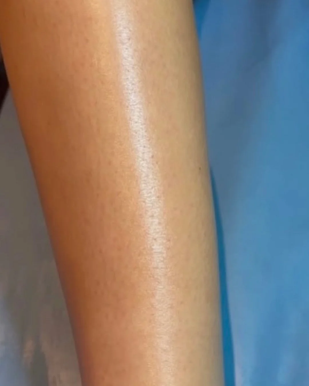 @skinbygene