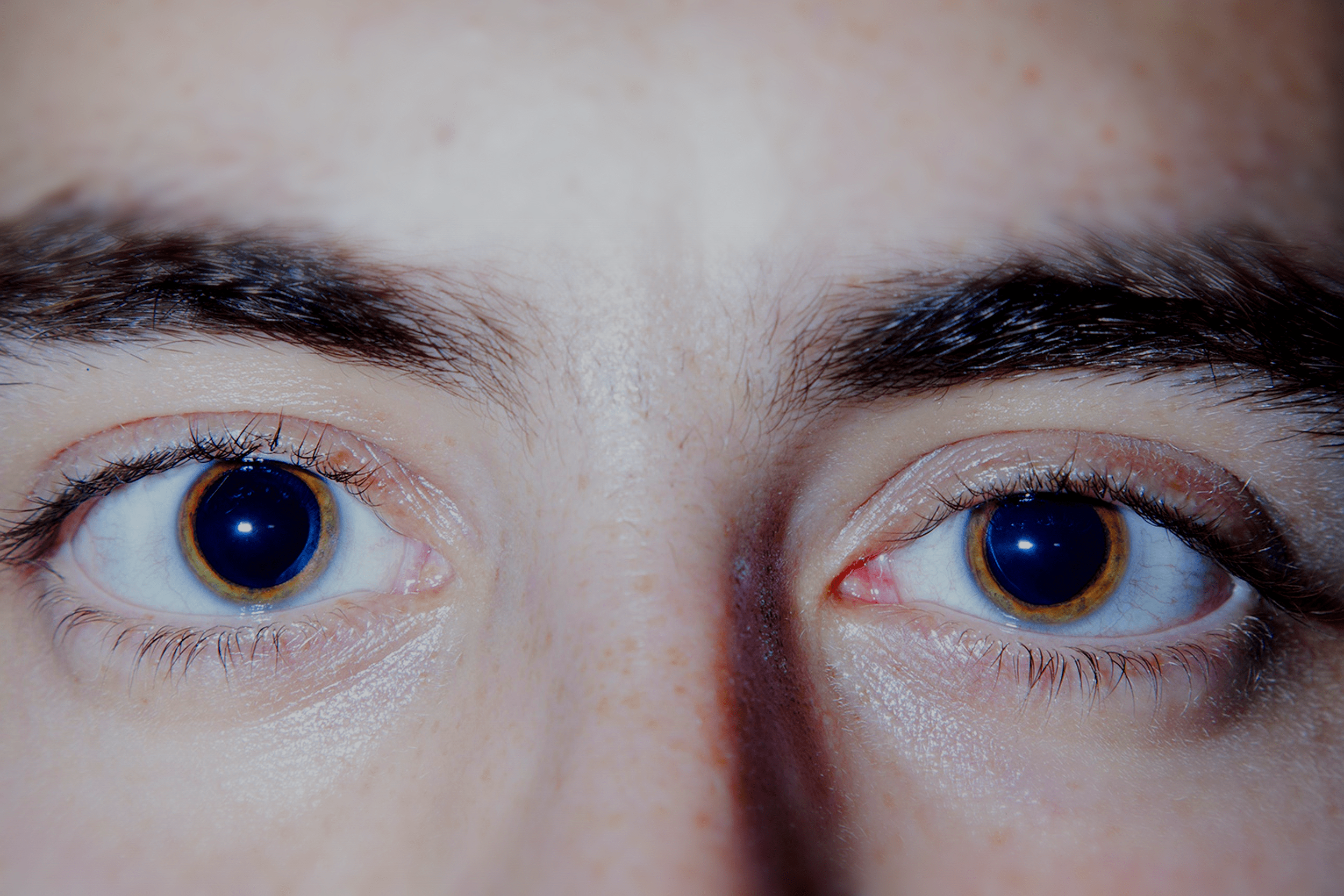 Impairment: The new kid on the block?