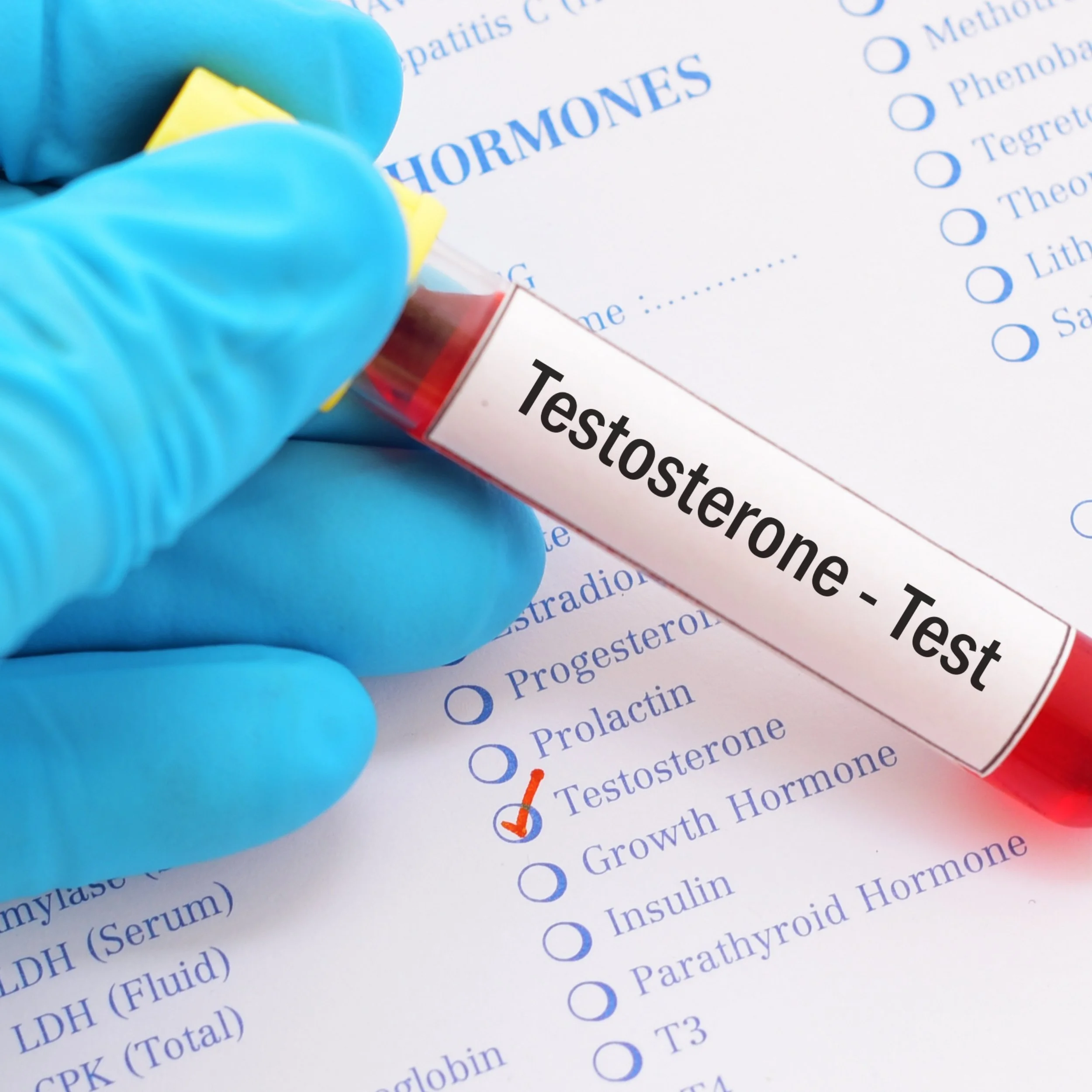 Does Adderall Lower Testosterone?  The Definitive Guide - u4io77q