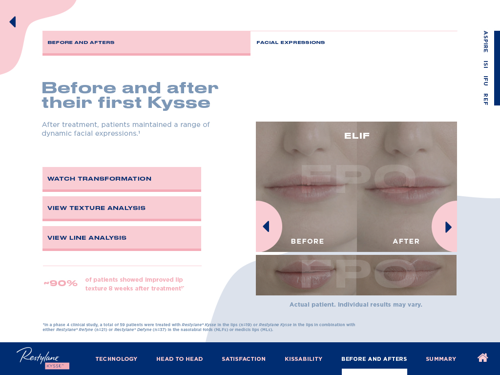 20-GALGE-0930-KYSSE-HCP-Pieces-IVA-V8_Page_24.png