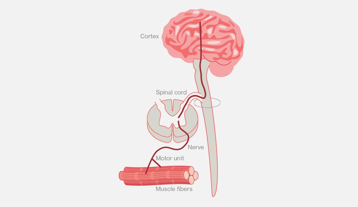 The role of EMG and kinematic measurements for objective symptom evaluation<br>