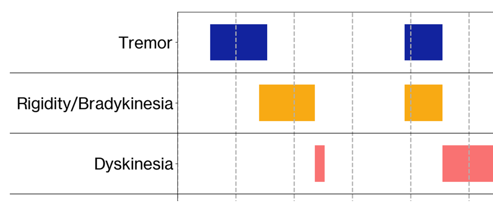 Bar graph showing Parkinson's symptoms and dyskenisia