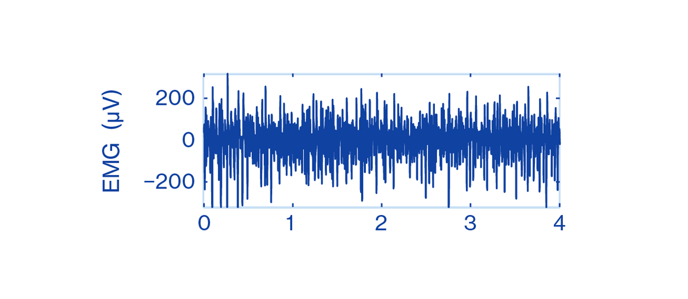 Elektromyographie, EMG, EMG-Signal, Signal