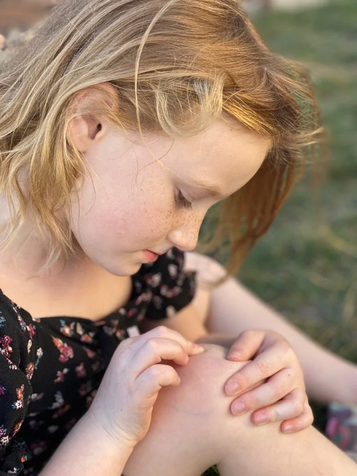 HM - A Little Scratch by Connie Janzen