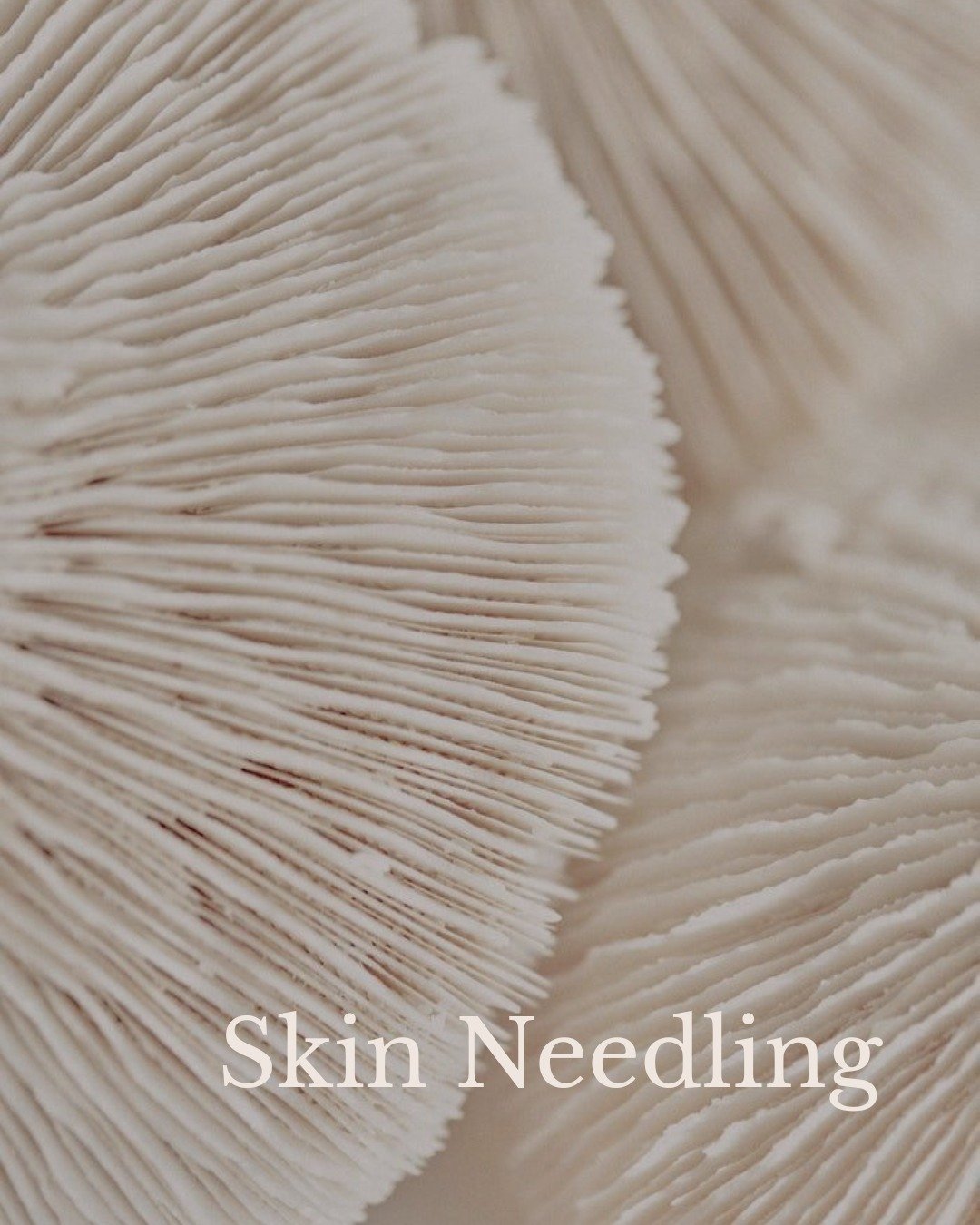 ✨ SKIN NEEDLING &mdash; the collagen comeback your skin&rsquo;s been craving ✨

Microneedling/skin needling works by creating tiny micro-injuries in the skin to trigger your body&rsquo;s natural healing response &mdash; boosting collagen and elastin 