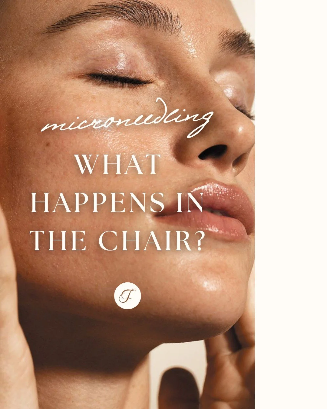 Spoiler alert: it&rsquo;s not nearly as scary as it sounds. Here&rsquo;s the microneedling play-by-play:
Step 1: Cleanse &mdash; because a fresh canvas is essential.
Step 2: Numbing cream (yes, we&rsquo;re kind but this is totally optional).
Step 3: 