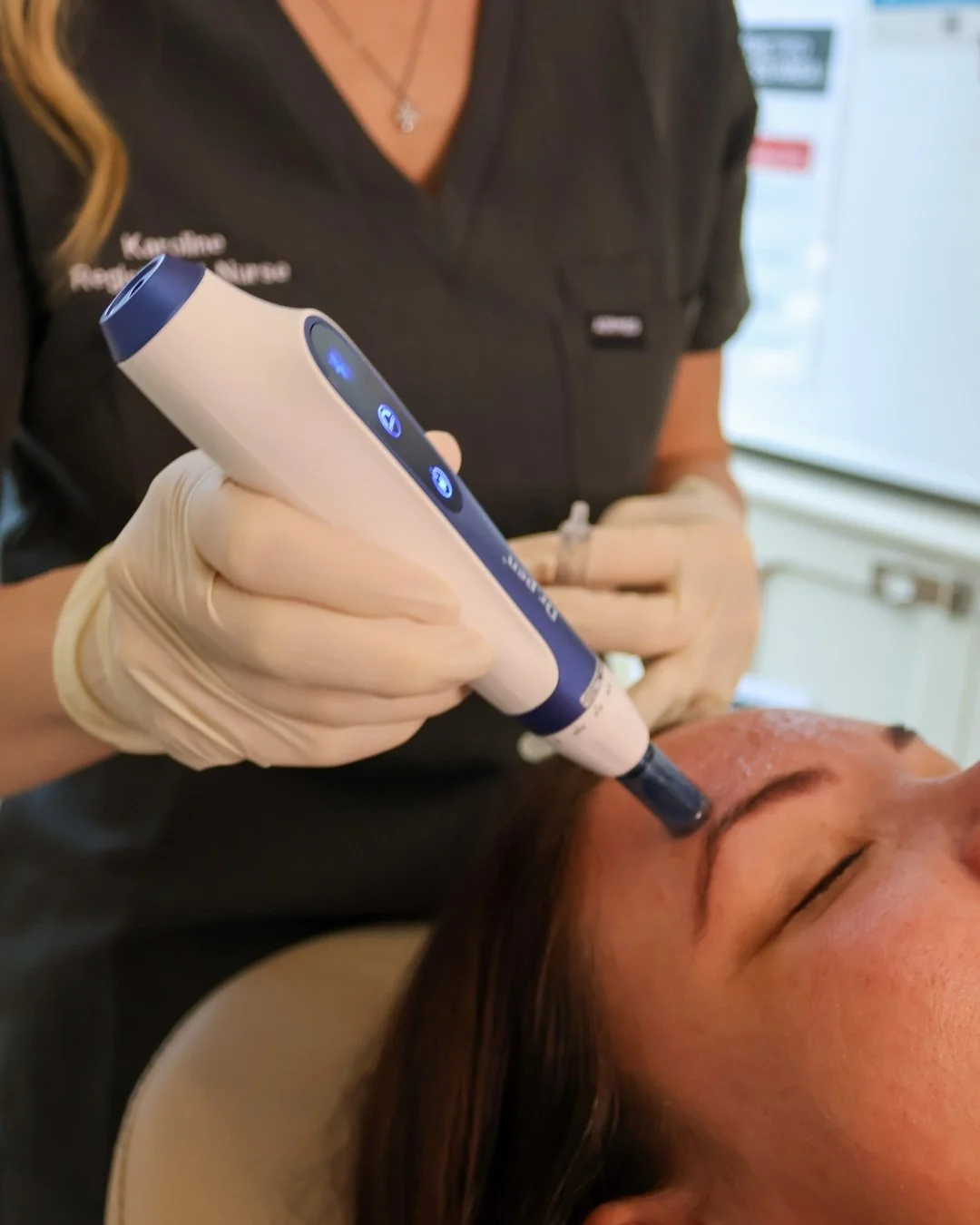 Microneedling works by stimulating your skin&rsquo;s natural repair process, helping to refine texture, minimise the look of pores, and leave your complexion looking and feeling refreshed.

Finesse Face &amp; Beauty also offers a range of skin booste