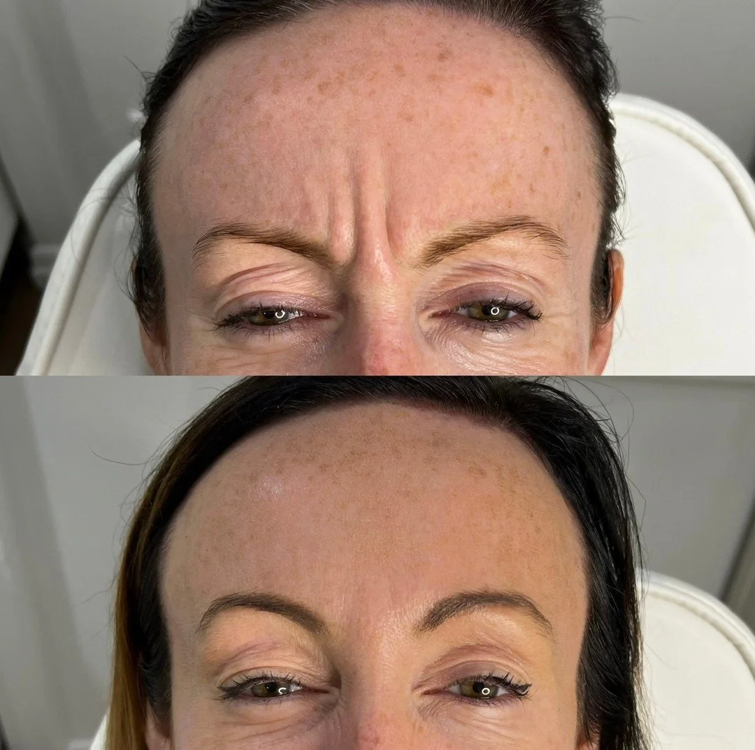 No two faces are the same &mdash; which is why no two treatment plans should be either. What you see here are the results of an individual treatment plan, created after a thorough consultation to understand this person&rsquo;s goals and needs.

A con