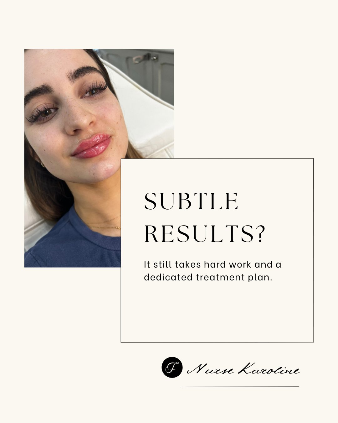 Real results don&rsquo;t always scream &mdash; sometimes they whisper.
But don&rsquo;t be fooled: the quiet treatments, the gradual glow-ups, the low-key collagen builders? They&rsquo;re the real game-changers.

No flash. No drama. Just skin that get