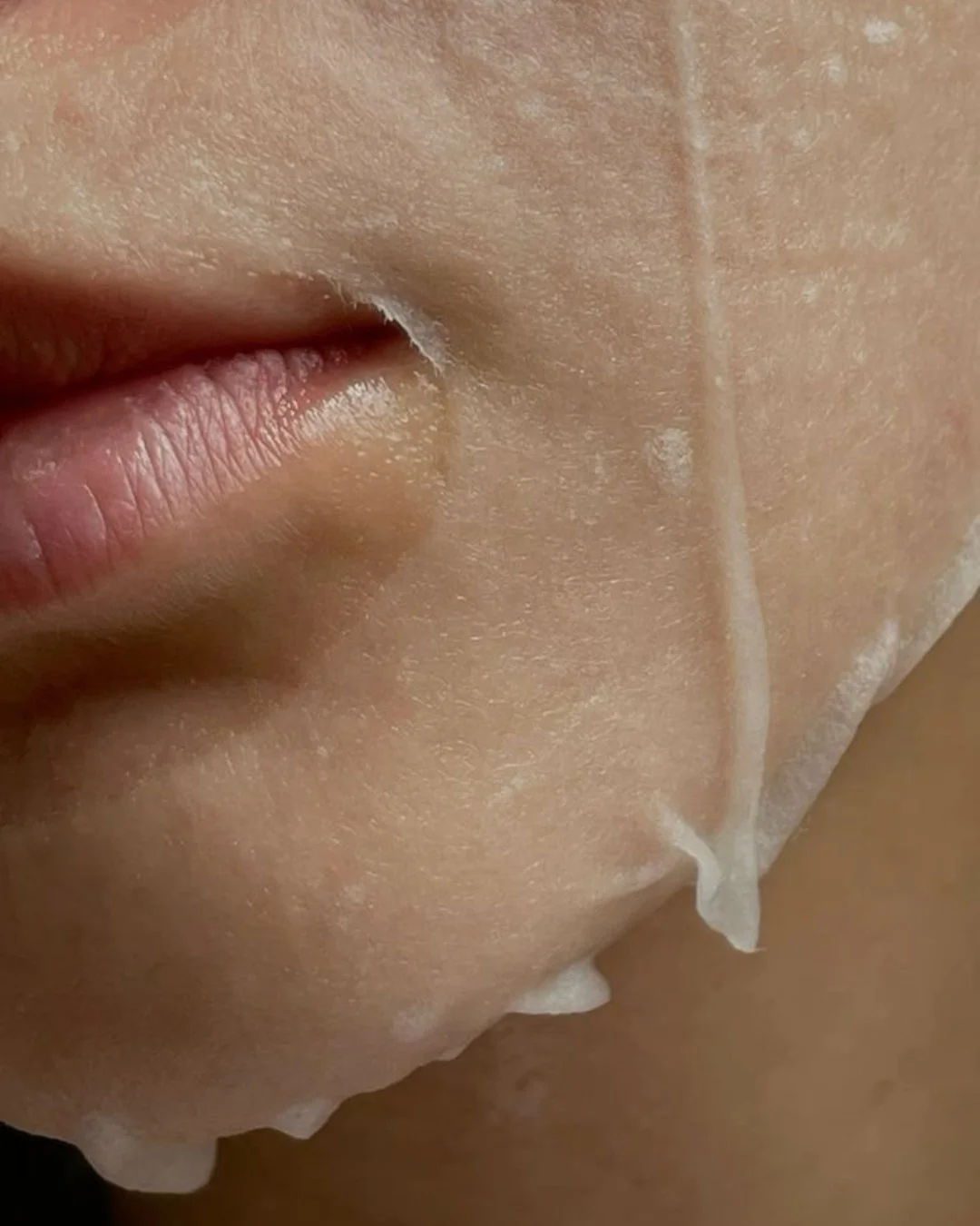 Hey gf, it's time to stop relying on that little sheet mask to fix your dull skin!

Kl&aacute;rdie R+ is a professional brightening booster used with microneedling to target uneven tone, pigmentation and dullness while supporting your skin&rsquo;s na