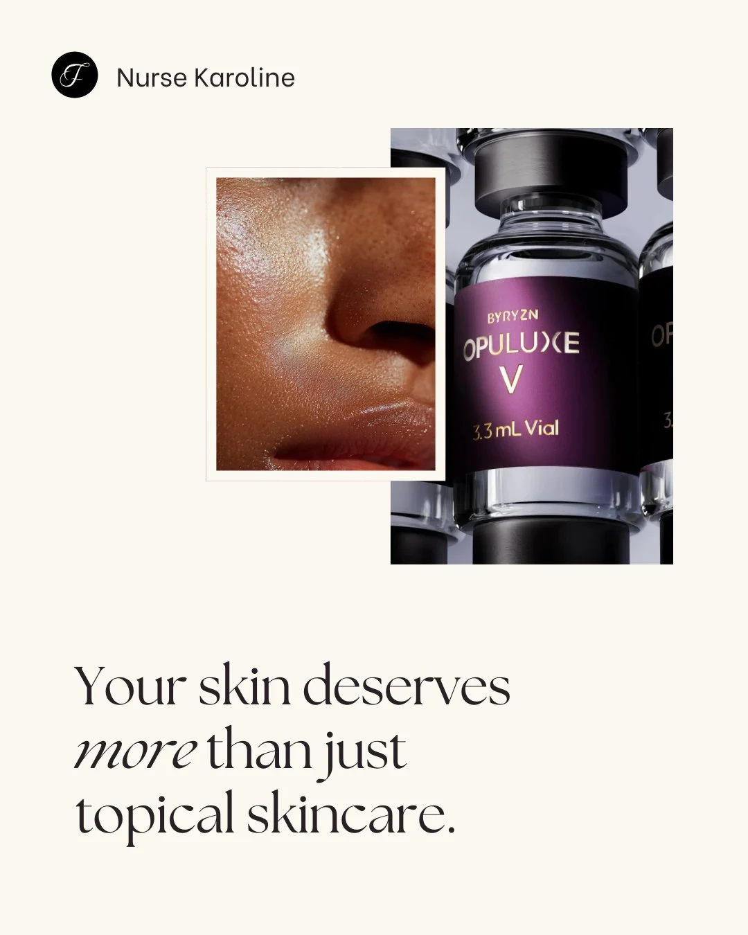 For many people, there comes a point where serums and creams alone don&rsquo;t quite deliver the change they&rsquo;re hoping for. Skin can start to feel dull, dehydrated, or uneven in texture, even with a consistent routine at home.

Opuluxe V is des