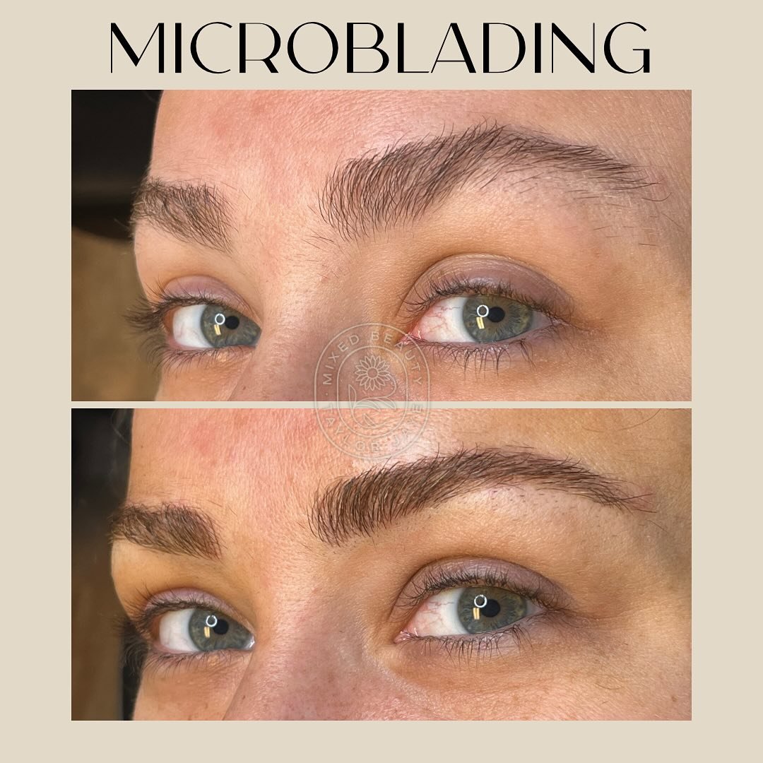 If you already have thick eyebrows but find them lacking in definition, shape, or have random sparse areas, microblading may be an excellent option for you. This technique enhances your brows by filling in gaps and creating a desirable fluffy appeara