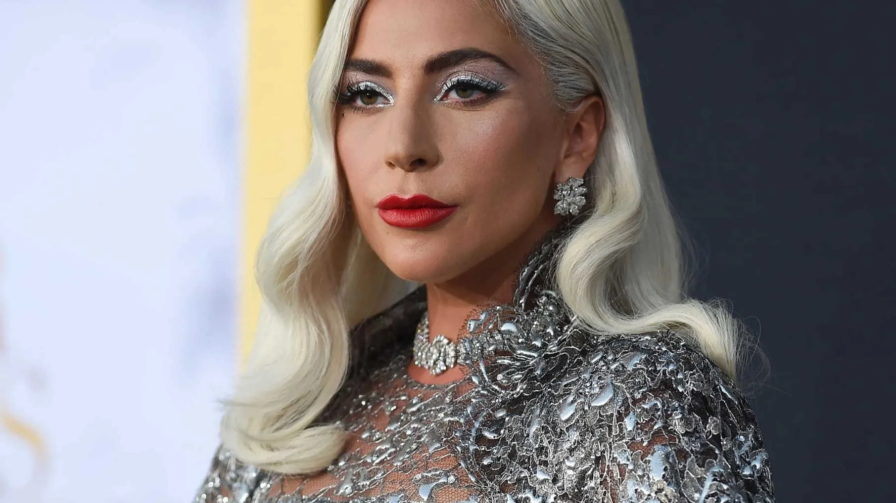Here are the Signs of Fibromyalgia Lady Gaga Felt