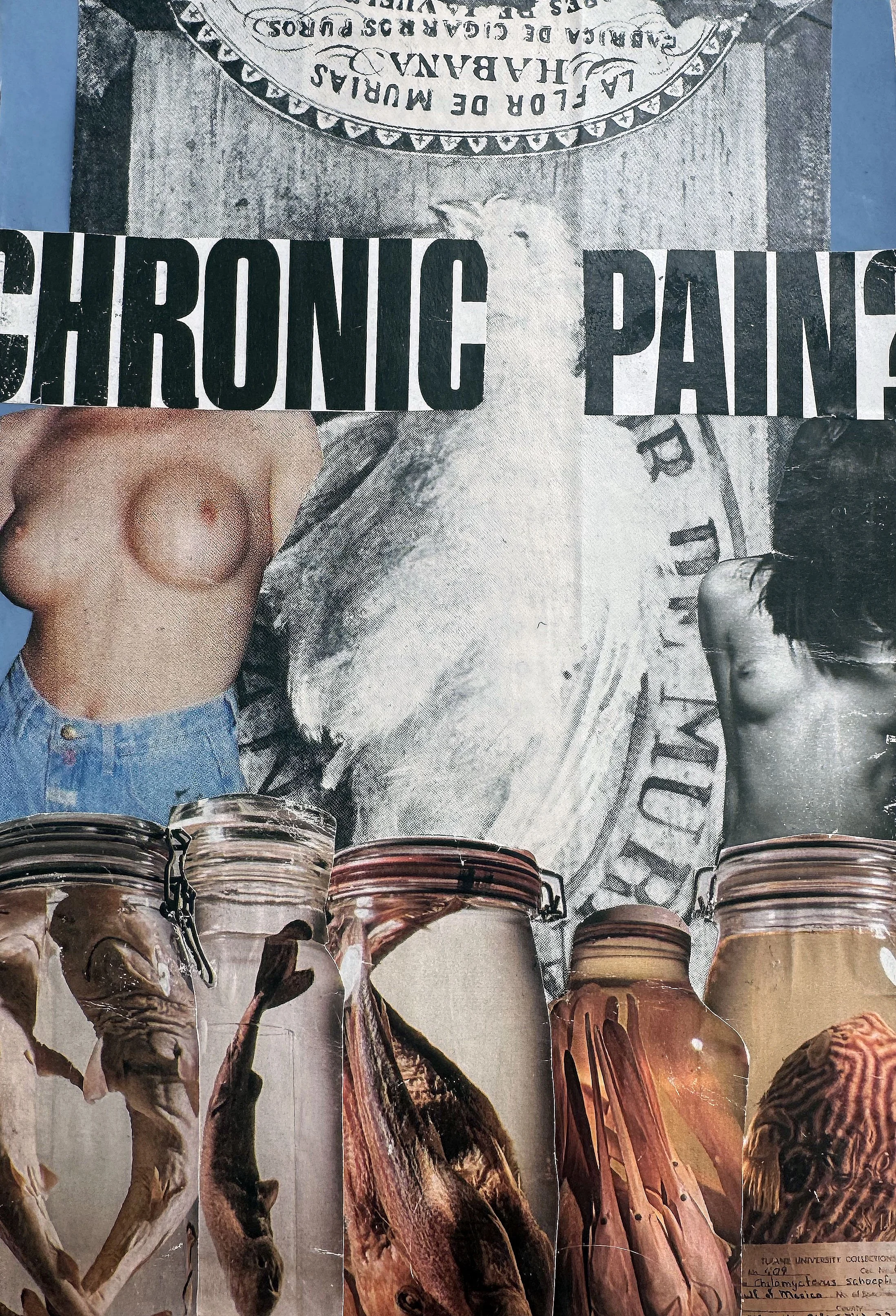“Chronic Pain”
2026