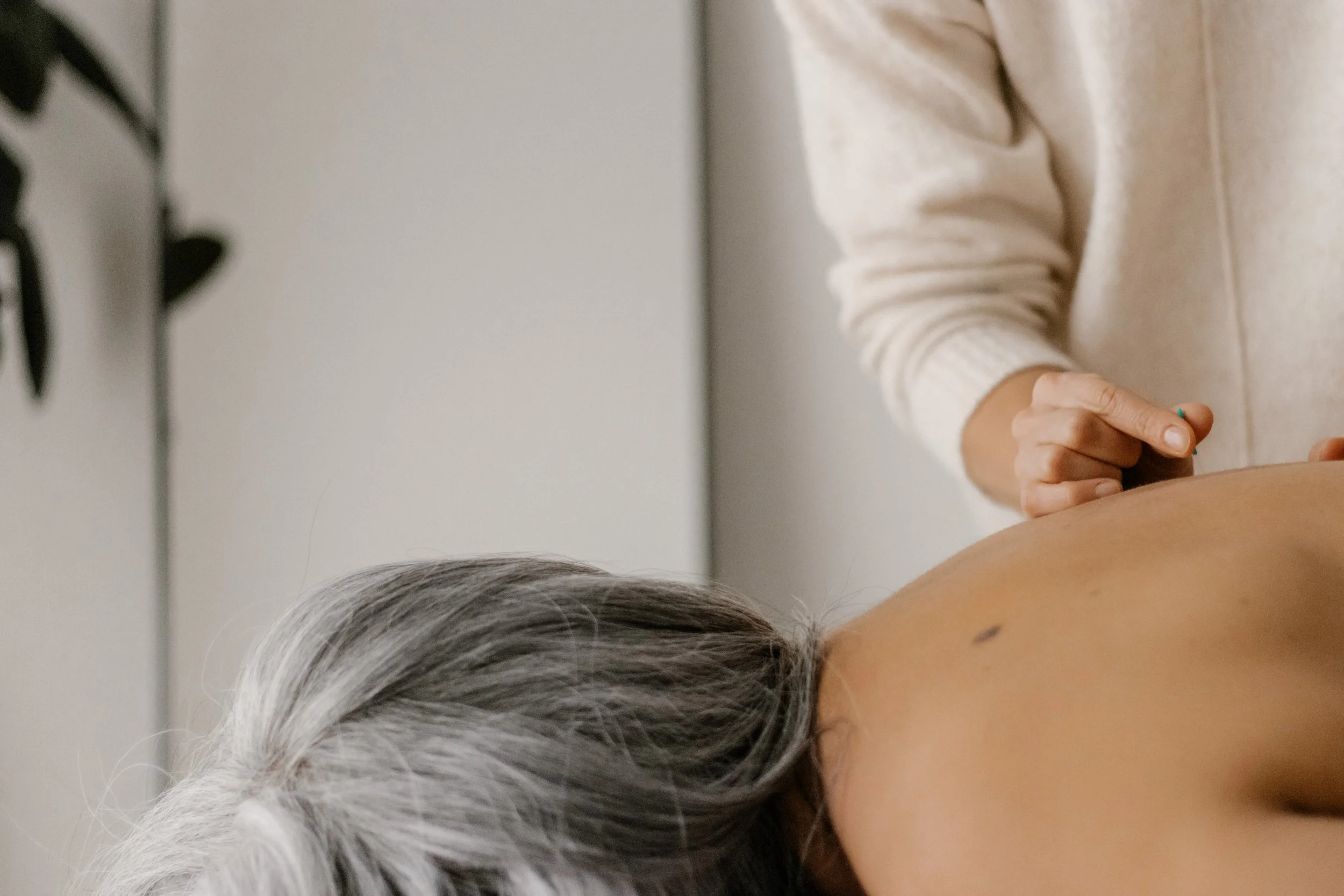 Person receiving acupuncture therapy on their back
