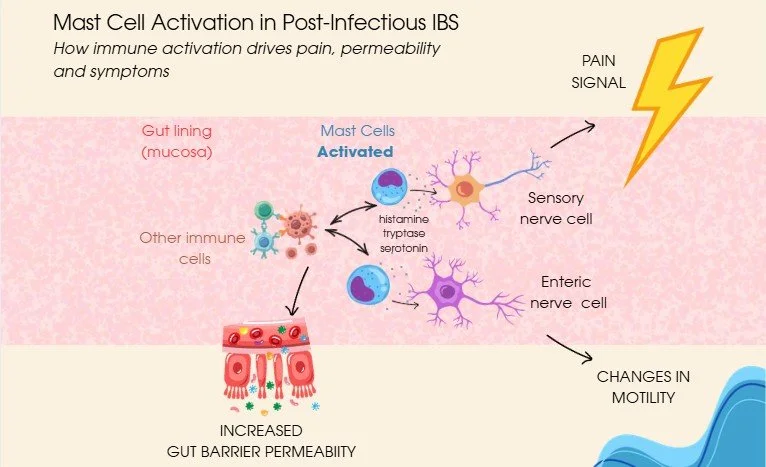 IBS, Inflammation and FODMAPs: How They Connect