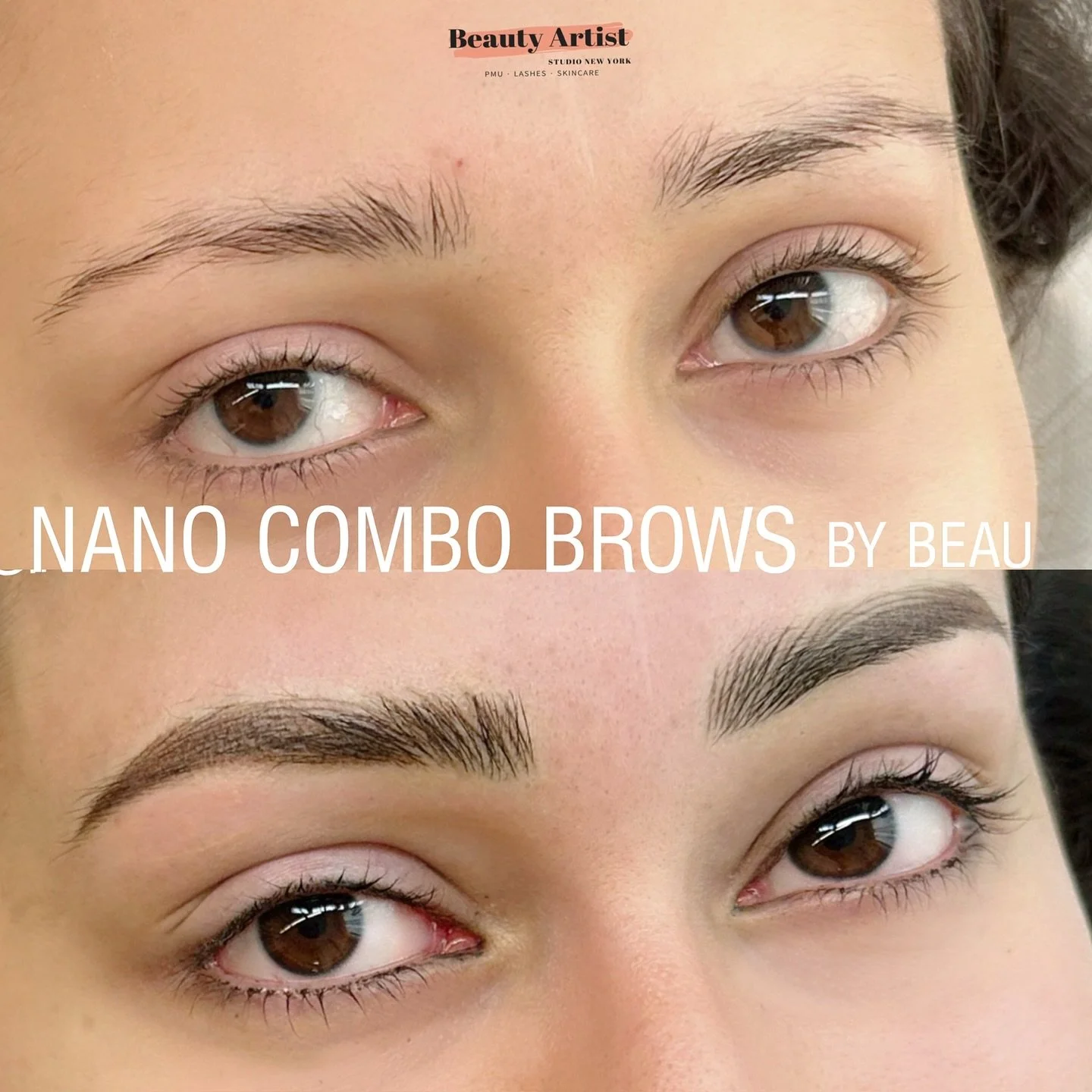 Before ➡️ After = Brow Perfection 🙌⁠
⁠
Nano Combo Brows give you the best of both worlds: hyper-realistic nano hair strokes + soft powdered shading for a fuller, natural yet defined look. 🌿⁠
⁠
This advanced technique is perfect for:⁠
&bull; Oily or