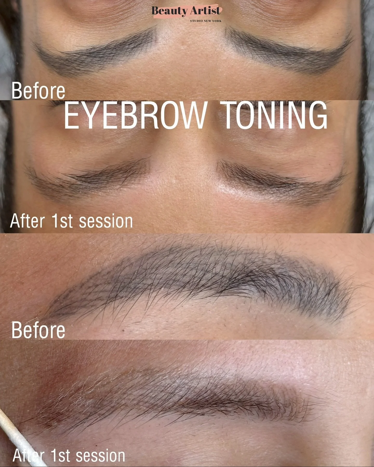 ✨ Real results, no filters &mdash; just pure toning magic.
Our Eyebrow Toning treatment gently lifts old or dark pigment to bring your brows back to a softer, more natural shade.

As the new year approaches, it&rsquo;s the perfect time to refresh you