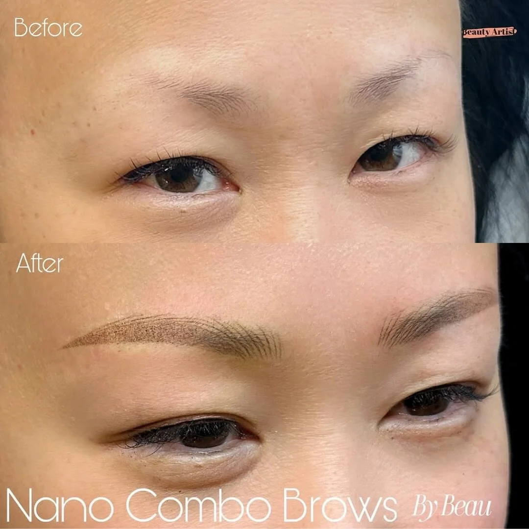 A perfect fusion of Nano Hair Strokes ➕ Powdered Shading✨⁠ Designed for a fuller, more defined brow with a natural, soft finish.⁠
⁠
This advanced technique is ideal for clients with oily skin, asymmetry, or previous brow tattoos that need correction.