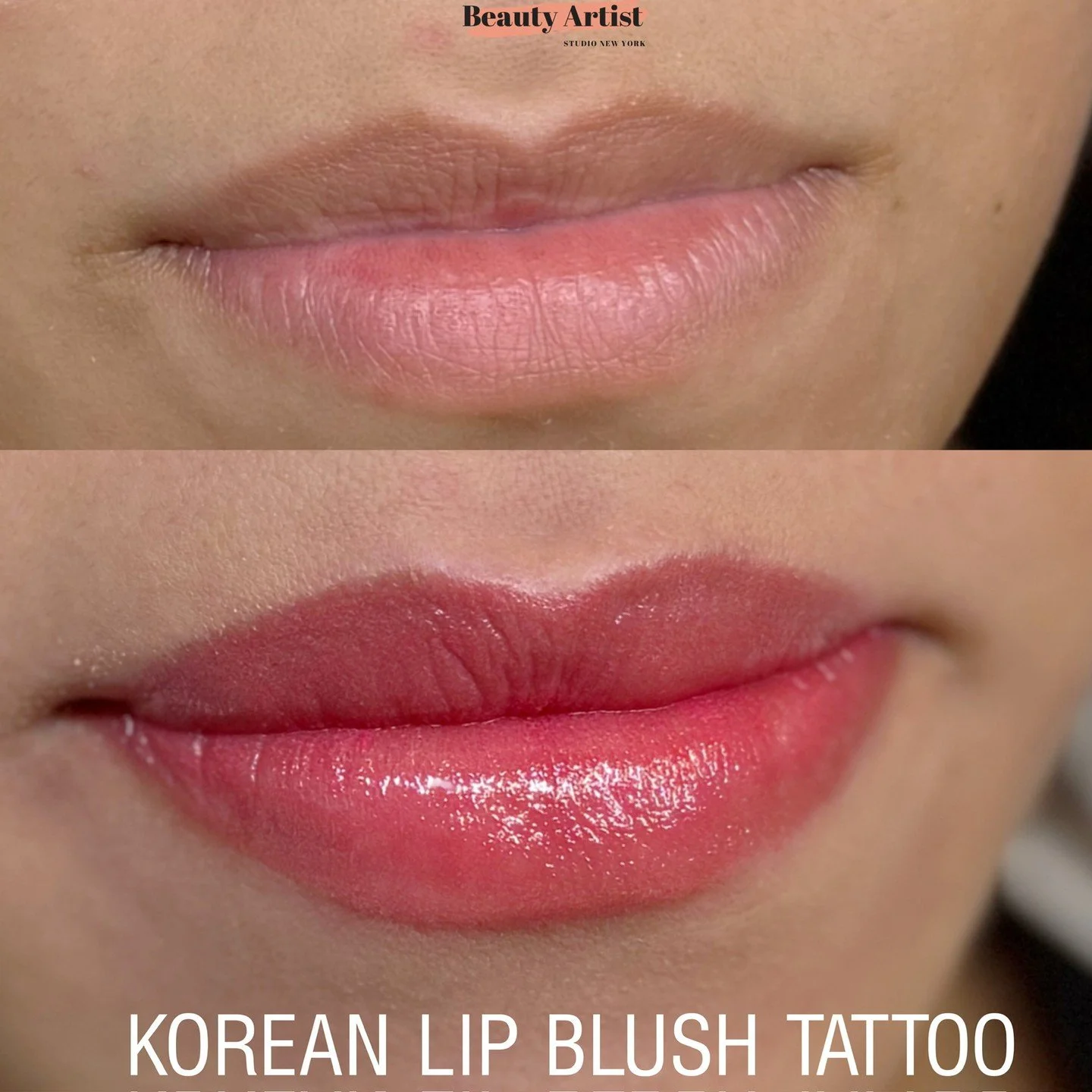 Korean Lip Blush is a soft, natural-looking lip tattoo technique designed to enhance your natural lip tone with a fresh, healthy tint.⁠
⁠
Instead of creating a heavy or lipstick-like look, this style focuses on a more subtle, gradient-inspired finish