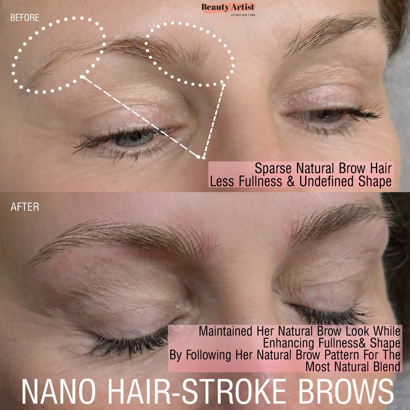 Our goal with this client was simple: create brows so natural that people notice she looks refreshed and beautiful&hellip; but can&rsquo;t quite figure out what changed 🤍⁠
⁠
That&rsquo;s the beauty of Nano Hair Stroke Brows &mdash; a soft, realistic