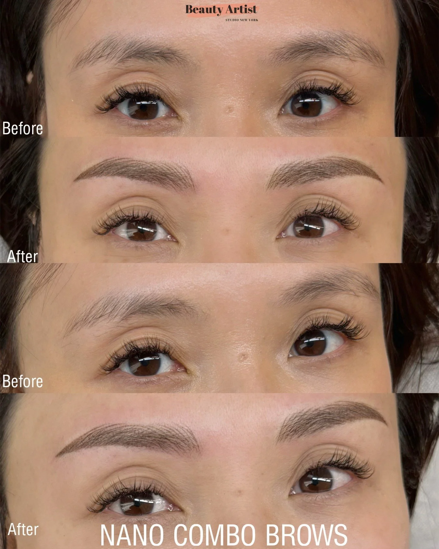 She wanted fuller, more defined brows while still keeping the overall look soft and natural.⁠
⁠
For this transformation, we created Nano Combo Brows &mdash; a combination of ultra-fine Nano Hair Strokes and Soft Powder Shading. The hairstrokes help m
