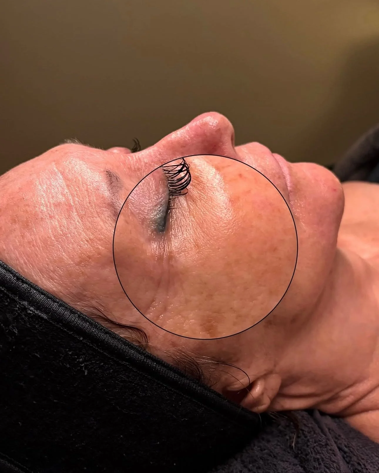 take a closer look at those results 👀🔍✨
@esthetics.by.khloe