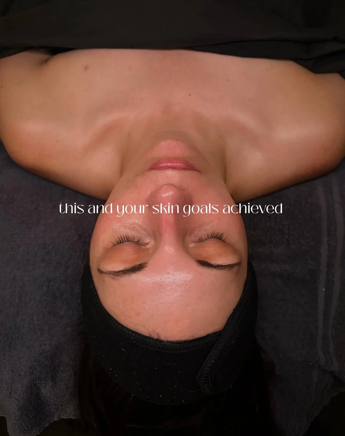 Ready to finally reach those skin goals of yours? Our girl @esthetics.by.khloe has just the regimen for you. Book your appointment to find yours today.