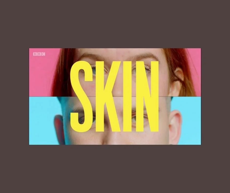 Celebrating Inclusivity: Lucy - La Sante House Featured on BBC iPlayer Documentary “Skin”