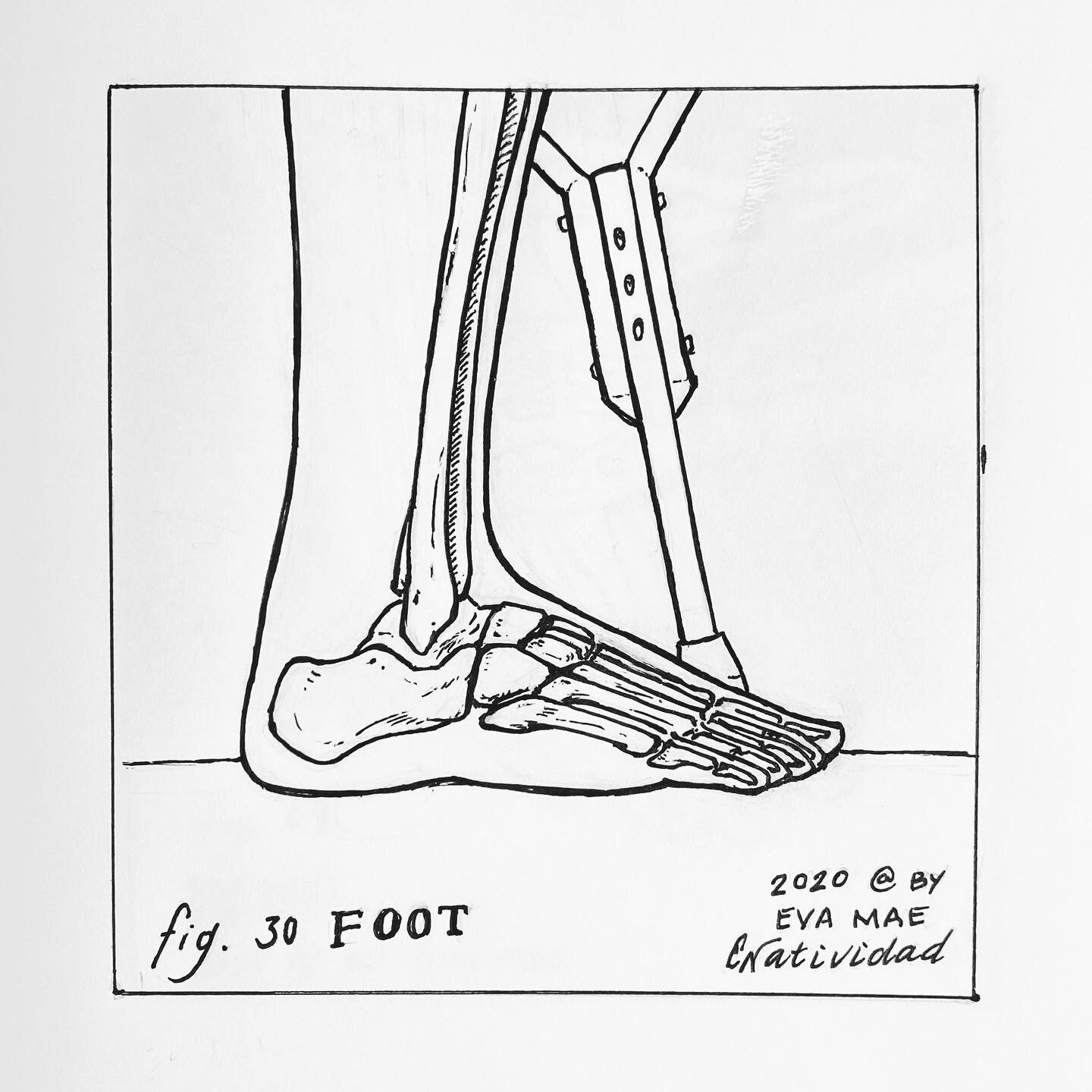 Fig. 30 Foot / Everyone has a right to healthcare. Over 6.5 million US adults have peripheral artery disease (PAD) which, if left untreated, could lead to tissue loss and limb amputation. Simple screenings and therapies to reverse this disease exist 