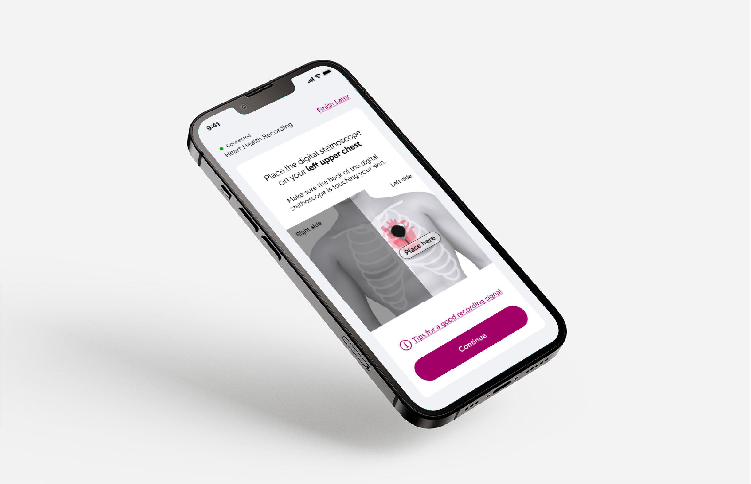 Complex Onboarding Redesign